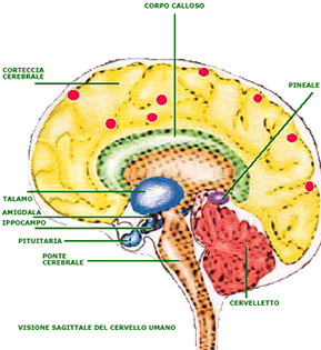 Visionde sagittale del cervello umano